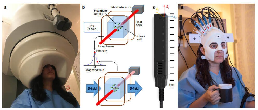 Atomic Magnetometer Magnetoencephalography