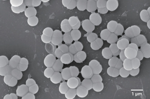 sem image analysis Streptococcus Genus